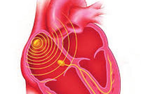 therapie-de-resynchronisation-cardiaque_5f57578429736.jpg