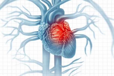 xlight-1189-17381-coeur-souffrant-d-insuffisance-cardiaque_627949e5a3df5.jpg